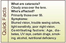 Quick Facts: Cataracts